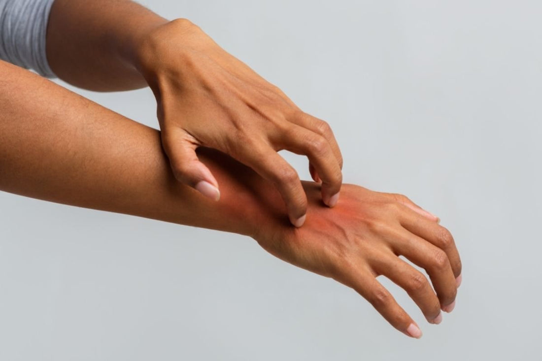 Can Your Gut Flora Help With Psoriasis? - Balance ONE